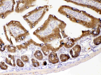 Anti-GALE Antibody