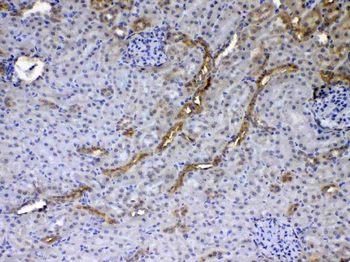 Anti-GALE Antibody