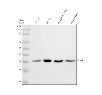 Anti-GALE Antibody