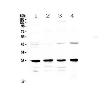 GSTM1 Antibody
