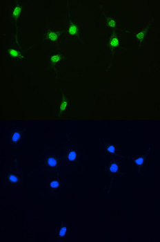 Anti-XRCC1 Antibody