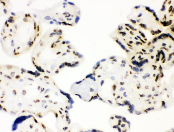Anti-XRCC1 Antibody