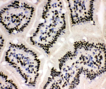 Anti-XRCC1 Antibody
