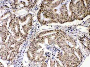 Anti-XRCC1 Antibody