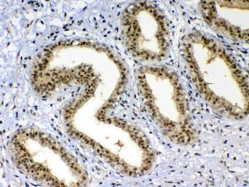 Anti-XRCC1 Antibody