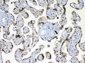 Anti-XRCC1 Antibody