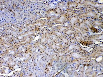 Anti-XRCC1 Antibody
