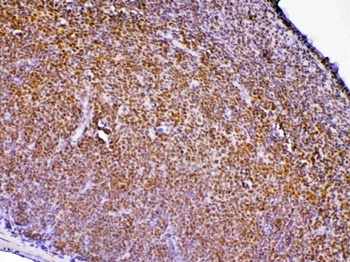 PTPN22 Antibody