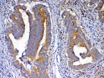 Anti-NSF Antibody