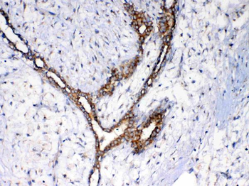 Anti-NSF Antibody