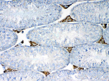 Anti-NSF Antibody
