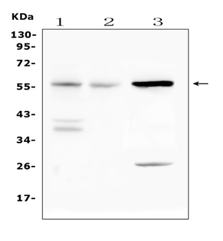 Anti-IL23 Receptor/Il23r Antibody