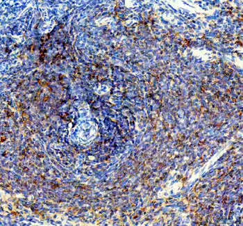 Anti-PTP1B/PTPN1 Antibody