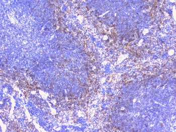 PTP1B/PTPN1 Antibody