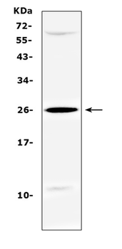 SRY Rabbit Polyclonal Antibody