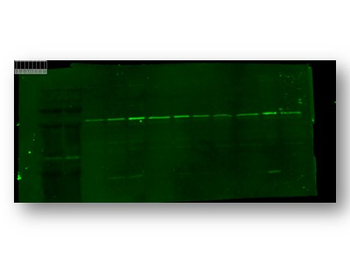 Anti-TRPC6 Antibody