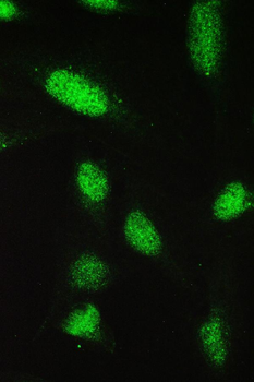 Anti-PAX5 Antibody
