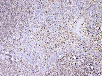 Anti-PAX5 Antibody