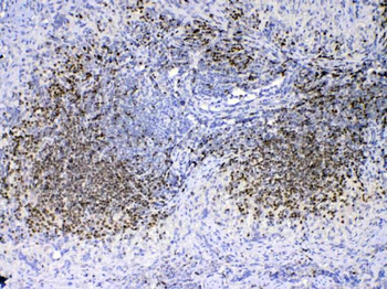 Anti-PAX5 Antibody