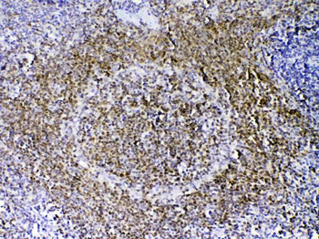 Anti-PAX5 Antibody