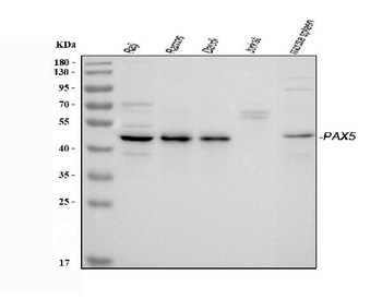 Anti-PAX5 Antibody
