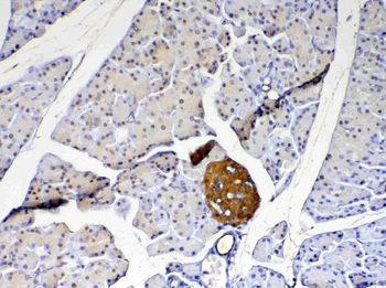 Anti-PARK7/DJ1 Antibody