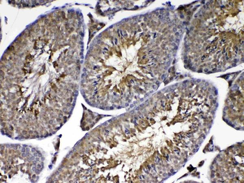 Anti-PARK7/DJ1 Antibody