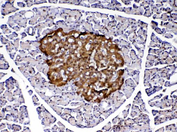 Anti-PARK7/DJ1 Antibody