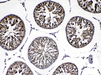 Anti-PARK7/DJ1 Antibody