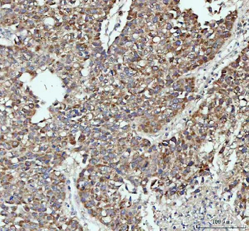 Anti-PAH Antibody