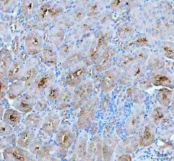 Anti-PAH Antibody