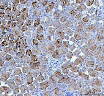 Anti-PAH Antibody