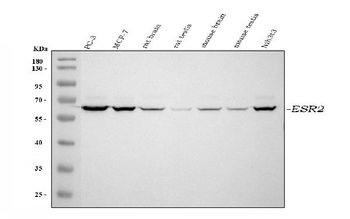Estrogen Receptor beta/ESR2 Rabbit Polyclonal Antibody