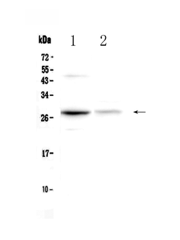 Anti-Oncostatin M/Osm Antibody