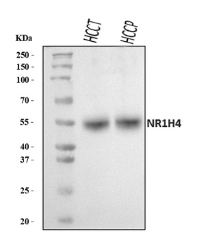 Bile Acid Receptor NR1H4 Antibody