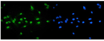 Anti-Bile Acid Receptor NR1H4 Antibody