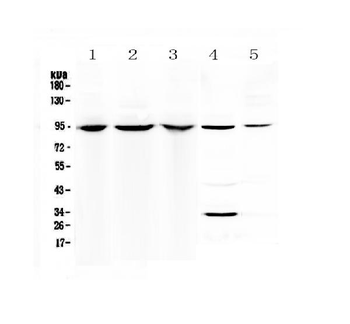 Complement C7 Rabbit Polyclonal Antibody
