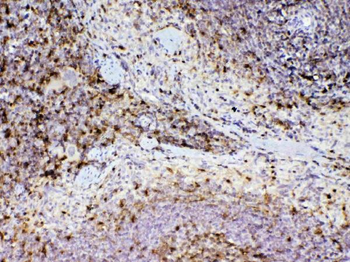 Anti-ADA Antibody