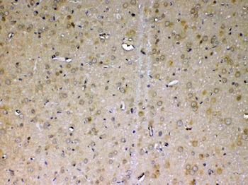 Anti-ADA Antibody