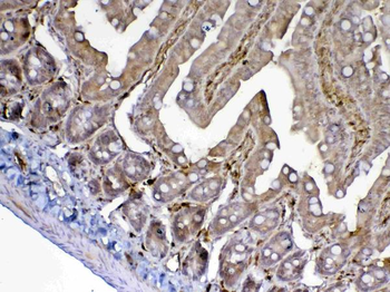 Anti-ADA Antibody