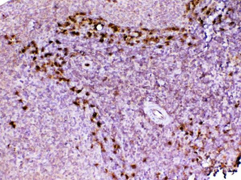 Anti-ADA Antibody