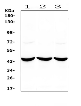 Anti-ADA Antibody