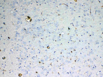 Anti-ADA Antibody