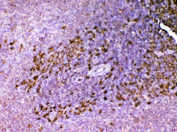 Anti-ADA Antibody