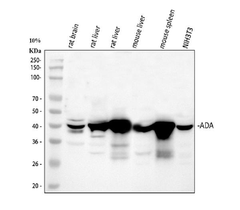Anti-ADA Antibody