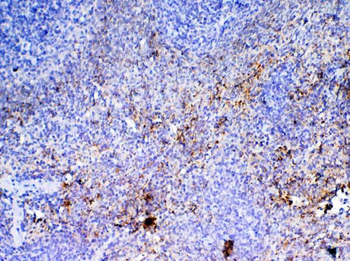 Anti-PF4 Antibody