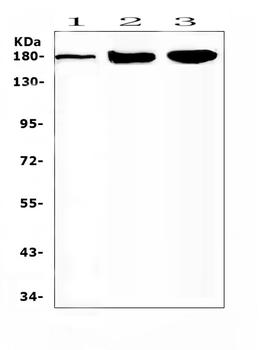 Anti-SUR1/ABCC8 Antibody