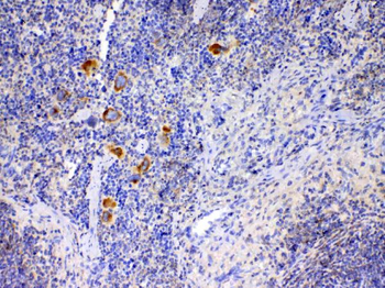 Anti-IL12A Antibody