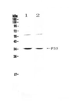 Anti-IL12A Antibody
