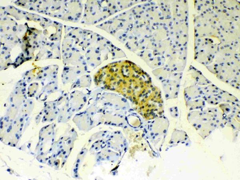 Anti-IGFBP1 Antibody